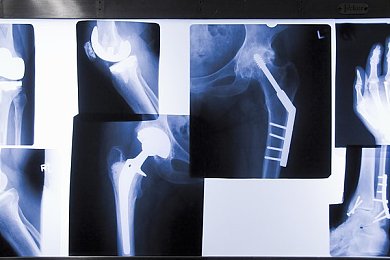 爱杏直播：短视频直播新势力崛起：爱杏平台引领行业发展，创新魅力吸睛无数